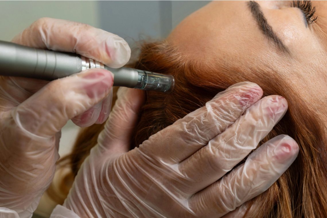 Scalp Micro-Circulation